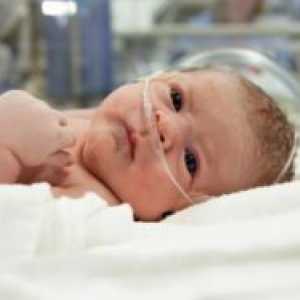 Cerebralna hemoragija u novorođenčadi