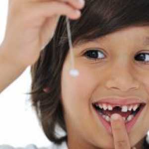 Mliječni zubi u djece - shema