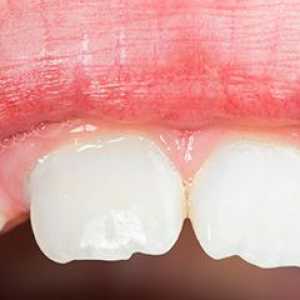 Mliječni zubi u djece