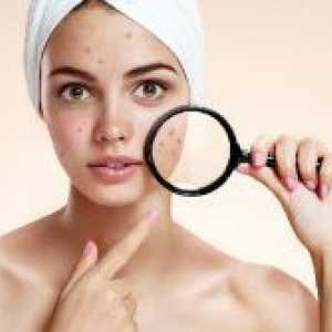 Je li moguće da obrišite lice s klorheksidin?