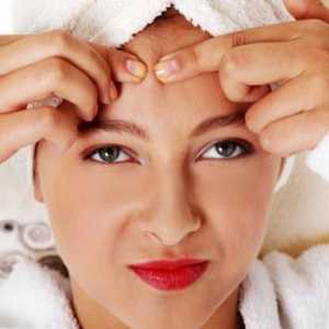 Je li moguće izliječiti acne gel?