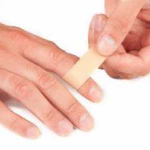 Apsces na prstu - Liječenje