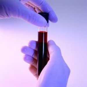 Norma bilirubina u krvi