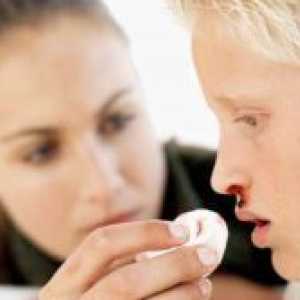Krvarenja iz nosa kod djece - uzroci