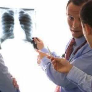 Opstruktivni bronhitis - liječenje