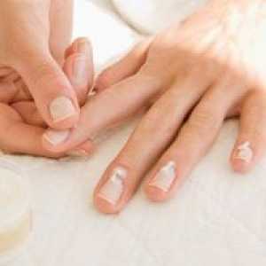 Onikomikoza noktiju - liječenje