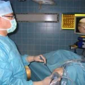 Kirurgija na meniskusa koljena