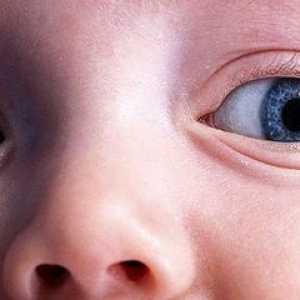 Natečene oči u djeteta - što učiniti?