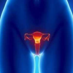 Tumor maternice - simptomi