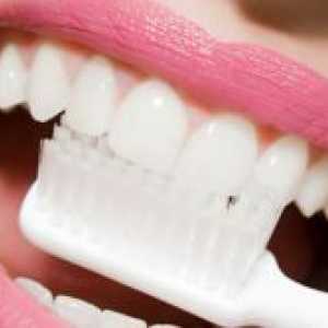 Izbjeljivanje zubi aktivni ugljen