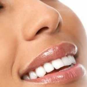 Izbjeljivanje zuba s vodikovim peroksidom