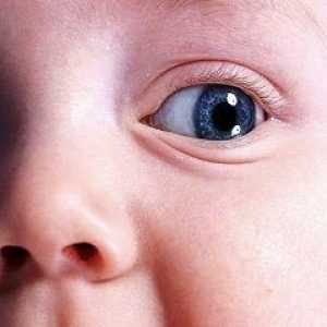 Oticanje djetetovih očiju