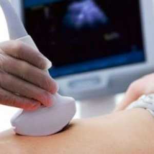 Prvi ultrazvuk u trudnoći