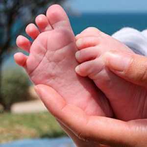 Ravnih stopala u djece