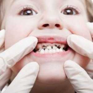 Zašto djeca pocrne mliječne zube?