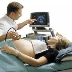 Pokazatelji Ultrazvuk 32 tjedana trudna