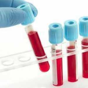 Smanjena hemoglobina - Simptomi