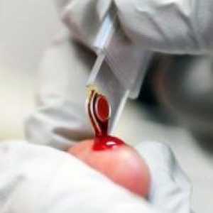 Povišeni hemoglobina u beba