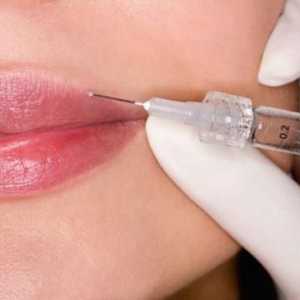 Princip rada i učinkovitosti Botoxa usana