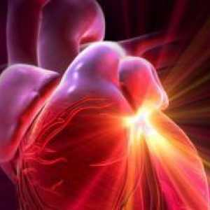 Stečena srčanih bolesti zalistaka