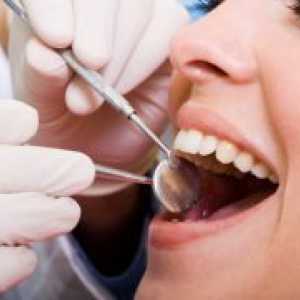 Stručni oralna higijena