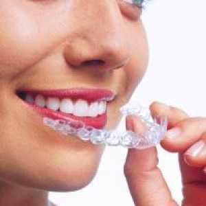 Prozirni štitnik za usklađivanje zubi