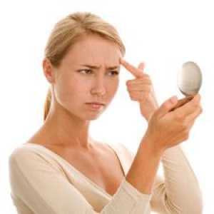 Akne na čelo: Uzroci, liječenje, kako ukloniti