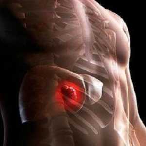 Raka jetre - prvi simptomi