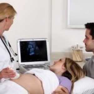 Raskorak između symphysis pubis u trudnoći