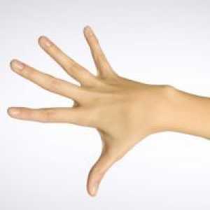 Istezanje mišića ruku - Liječenje