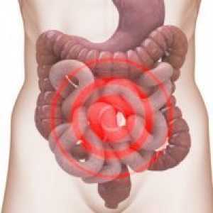 Upalna bolest crijeva - Simptomi