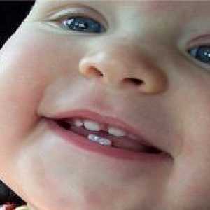 Koliko mlijeka zubi kod djece?