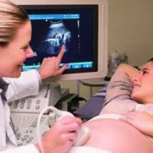 Koliko puta mogu učiniti ultrazvuk u trudnoći?