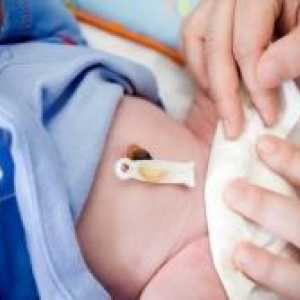 Kako se iscjeljivanje pupak novorođenčeta?
