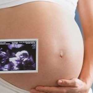 Screening u trudnoći