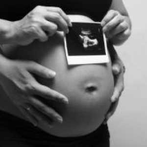 Gestacijska dob na ultrazvuku