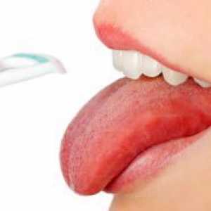 Rak čireve na jeziku - liječenje kod odraslih