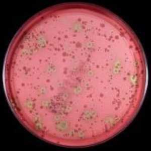 Streptococcus viridanskom