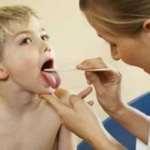 Streptokokne infekcije kod djece
