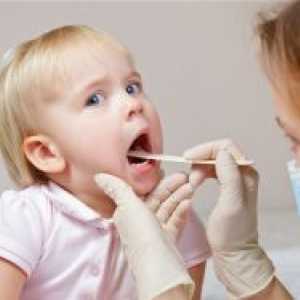 Tracheitis u djece - liječenje