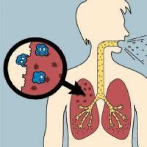 Tuberculosis - Liječenje