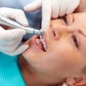 Uklanjanje zubnog kamen sa ultrazvuka