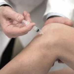 Injekcije za zglobove