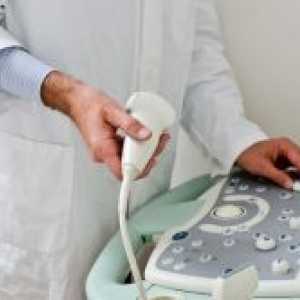 Ultrazvuk utvrditi trudnoću