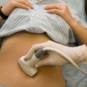 Karlica ultrazvuk kod žena