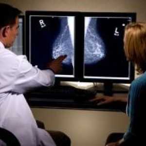 Ultrazvuk dojki - normalno