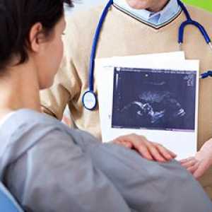 Fetalni Ultrazvuk po tjednu