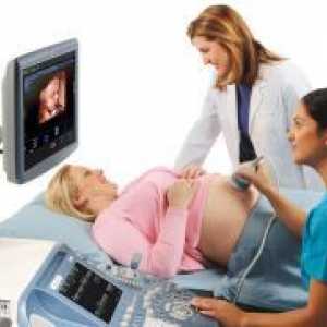 Dopler ultrazvuk - što je to?