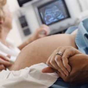Ultrazvuk srca fetusa