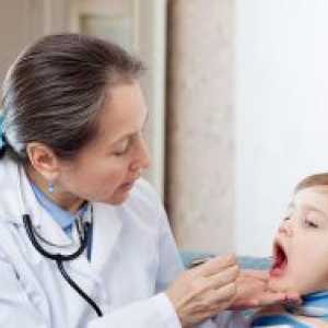 Virusni tonzilitis u djece
